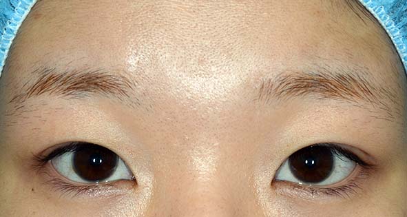 ブログ 東京 日本橋 銀座エリアの皮膚科 美容皮膚科なら池本形成外科 美容外科